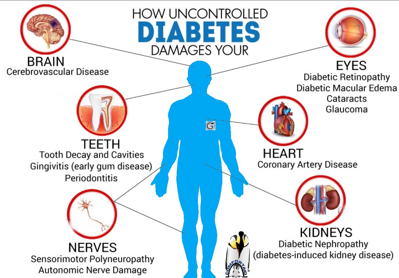 Juvenile Diabetes: Possible Complications - Gluxus Health - COMFORTAID